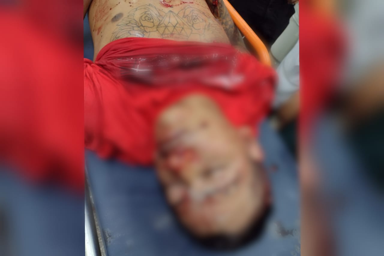 ailon da Silva Trindade, chegou a ser levado ao Hospital Platão Araújo, mas chegou na unidade sem vida.