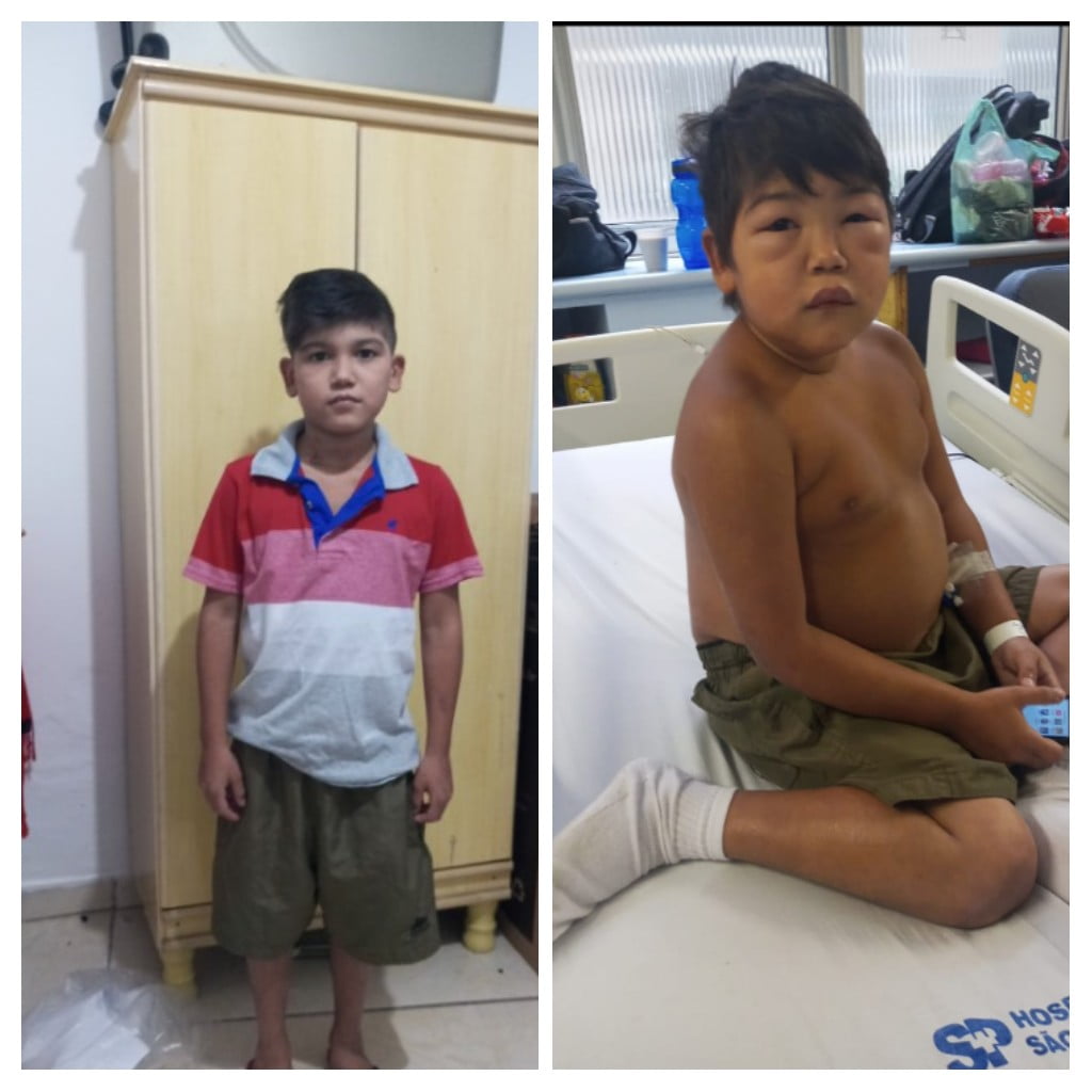 Isaque Emanuel Gama Oliveira, 12, está em São Paulo, lutando contra a síndrome nefrótica (Foto: Divulgação)